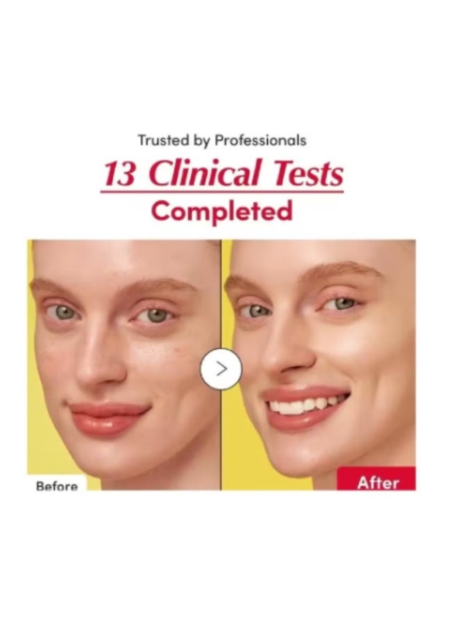 إيكوالبيري Eqqualberry Vitamin C Serum مع 15 ٪ مستخلص Acerola و 5 ٪ niacinamide | مجمع حمض السيراميد هيالورونيك لإصلاح الحاجز والترطيب العميق (30 مل/1.01 أوقية) - Image 4