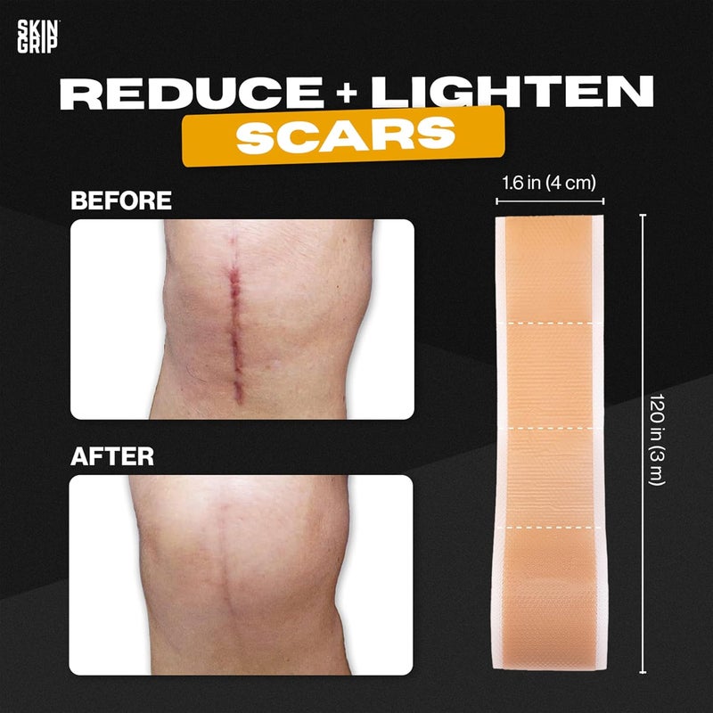 Skin Grip Medical Grade Silicone Scar Tape 16x120 Roll  Increased Strength  Reduced Irritation  Silicone Scar Sheets For Face Surgical Scars CSection Keloid Treatment Tummy Tuck Burn Acne - Image 4