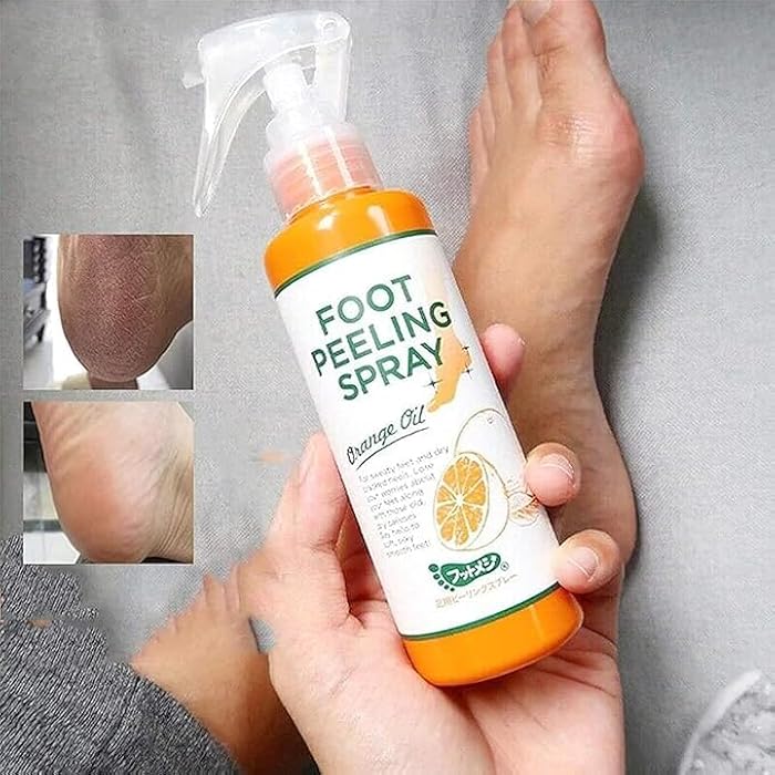 We agreed to choose an attractive marketing name Soft Feet for Korean Foot Exfoliator and Instant Foot Exfoliation Spray.Now you can enjoy soft and free feet - Generic - Image 1
