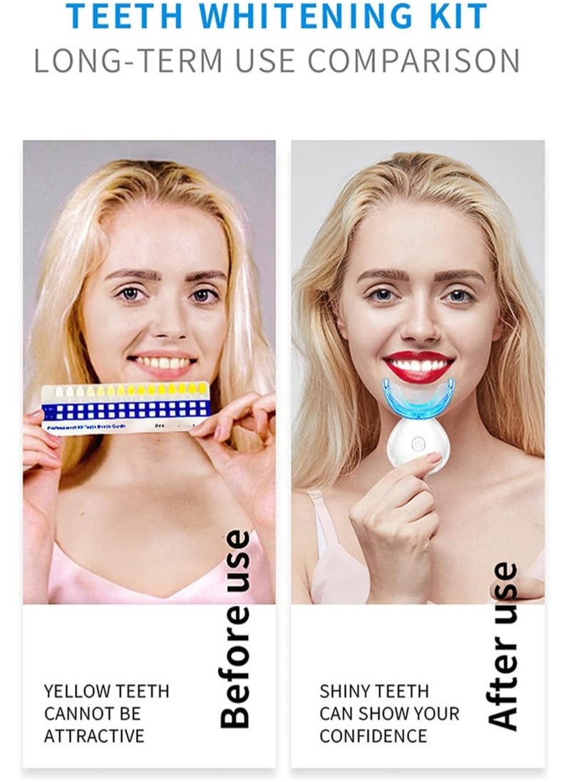 SMILEKIT - Teeth Whitening Kit with LED Light Teeth Whitening Gel Pen Mouth Tray, Hydrogen Carbamide Peroxide for Sensitive Teeth, LED Light Tooth Whitener, Teeth Stain Remover to Whiten Teeth - Image 1