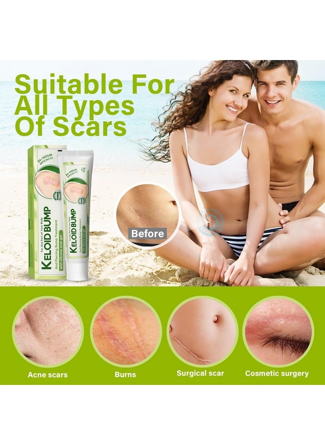 Hajoyful Keloid Bump Removal, Scar Treatment Cream, Silicone Acne Scar Gel, Gentle Effective Aftercare Solution for Injury & Surgery, Skin Repair for Face & Body, 20g  - Image 4