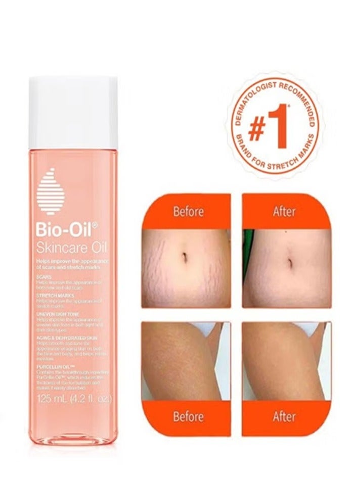 بايو أويل بيو اويل زيت جسم 125 مل - Image 1