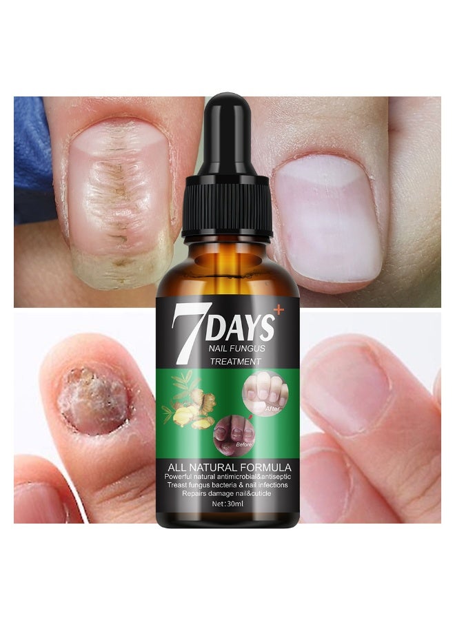 MOOYAM 7 Days Nails Fungus Treatment, Moisturize the Cuticle & Strengthen Nails and Helps Nails Healthy Grow Nail Repair Treatment Solution Restoring Healthy Nails 30ml - Image 5
