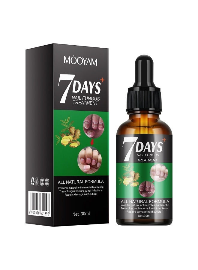 MOOYAM 7 Days Nails Fungus Treatment, Moisturize the Cuticle & Strengthen Nails and Helps Nails Healthy Grow Nail Repair Treatment Solution Restoring Healthy Nails 30ml - Image 1