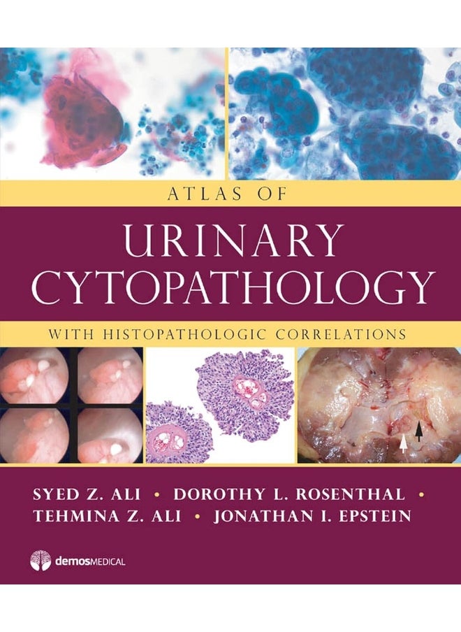 Atlas of Urinary Cytopathology: With Histopathologic Correlations 