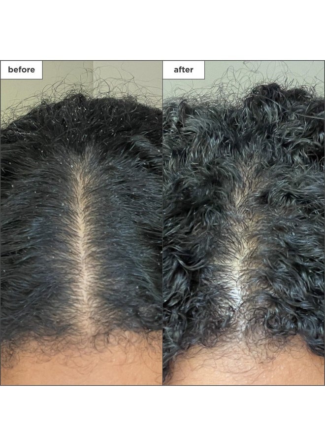 Briogeo - Briogeo Scalp Revival Charcoal + Coconut Oil Micro-Exfoliating Shampoo, Treatment for Dry & Itchy Scalp, Clarifying Shampoo for Build Up, Scalp Scrub for Oily Scalp, Vegan, Cruelty-Free, 2 fl oz - Image 1