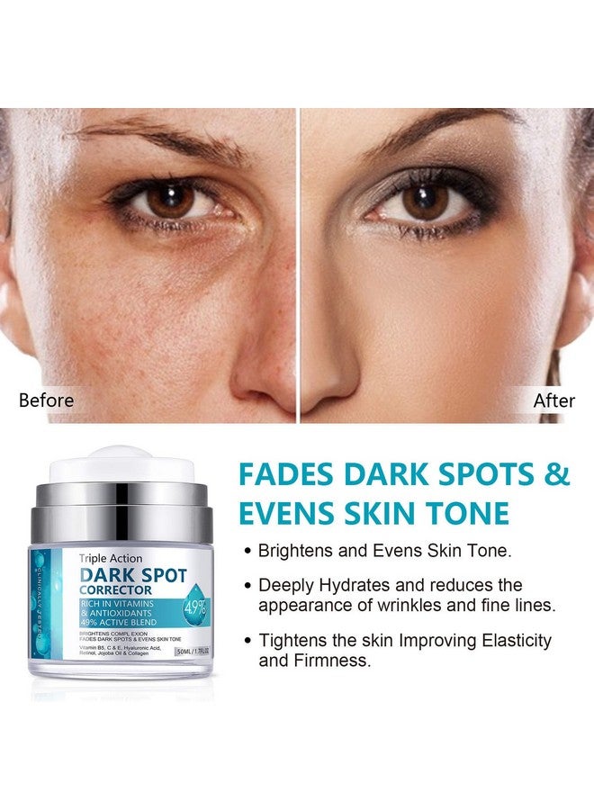 Rosarden Dark Spot Remover For Face And Body Dark Spot Corrector Cream Dark Spot Corrector Cream For Age Spot Blemish Spot Melasma Freckle Sun Spots Remover & Blemish Reducer For Women Men - Image 3