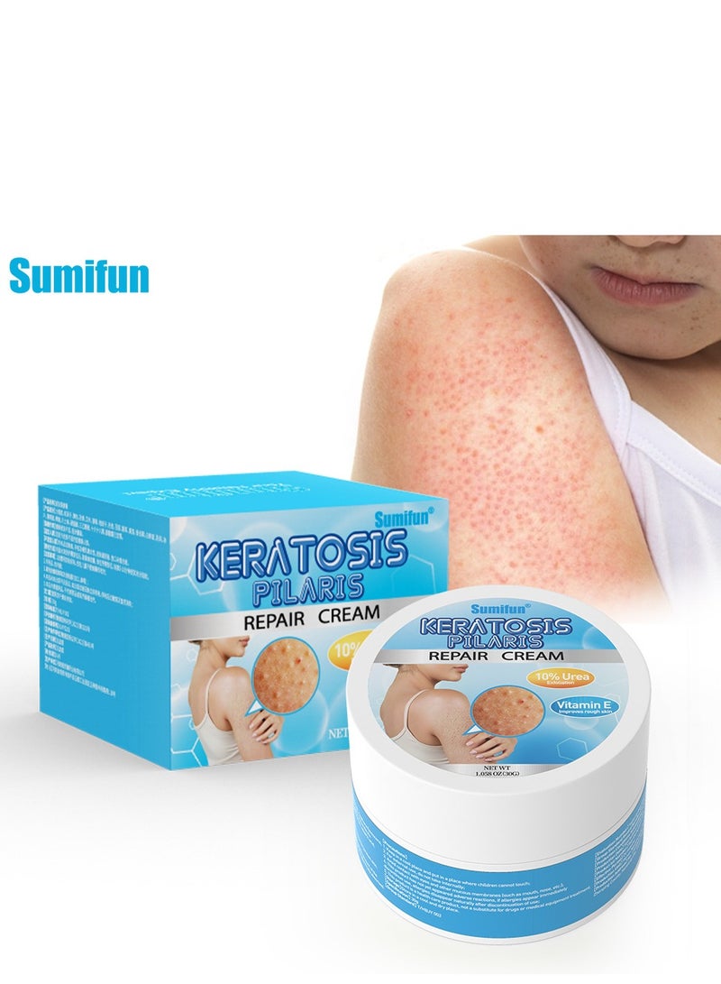 Sumifun Keratosis Pilaris Repair Cream,Vitamin E cream, urea to remove dead skin cells 30g - Image 1