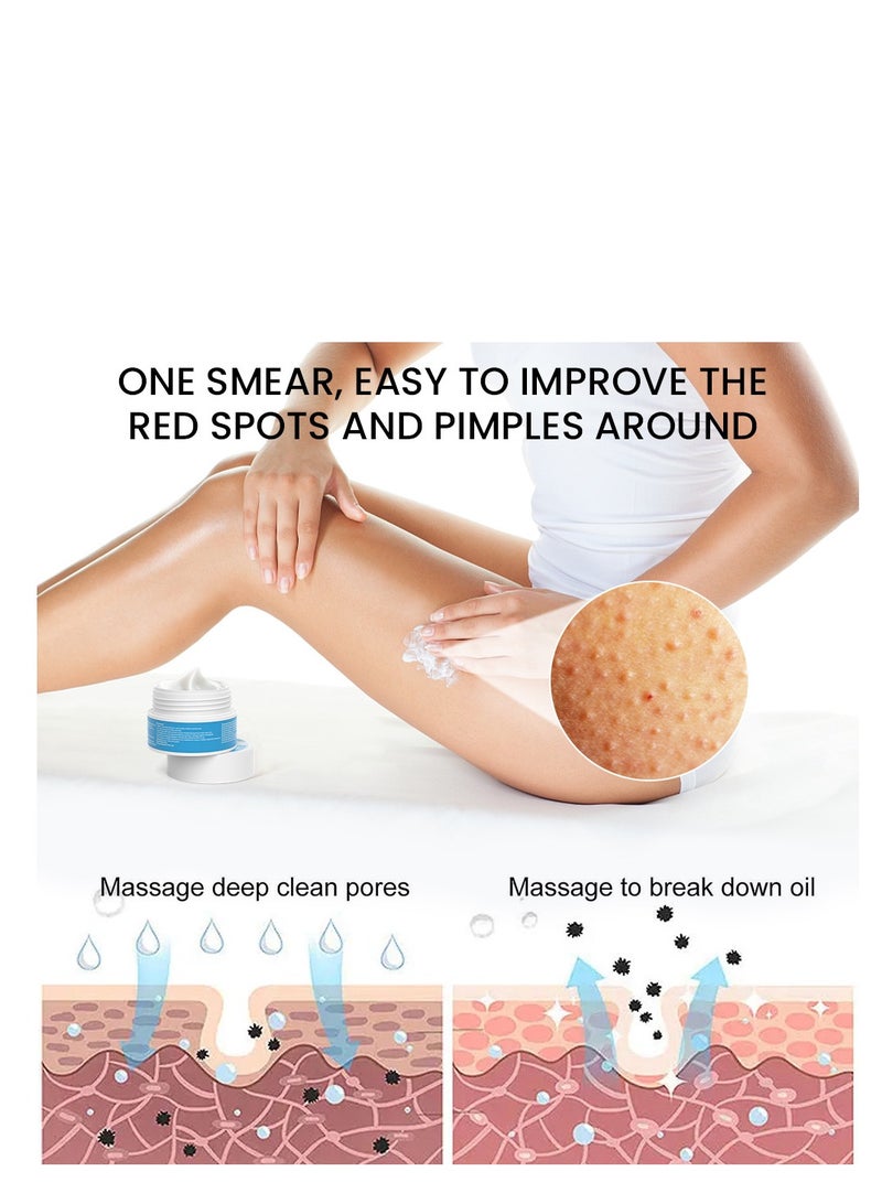 Sumifun Keratosis Pilaris Repair Cream,Vitamin E cream, urea to remove dead skin cells 30g - Image 3