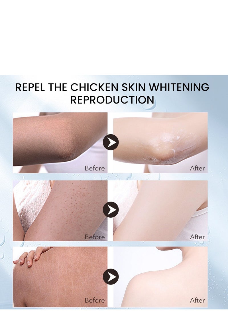 Sumifun Keratosis Pilaris Repair Cream,Vitamin E cream, urea to remove dead skin cells 30g - Image 4