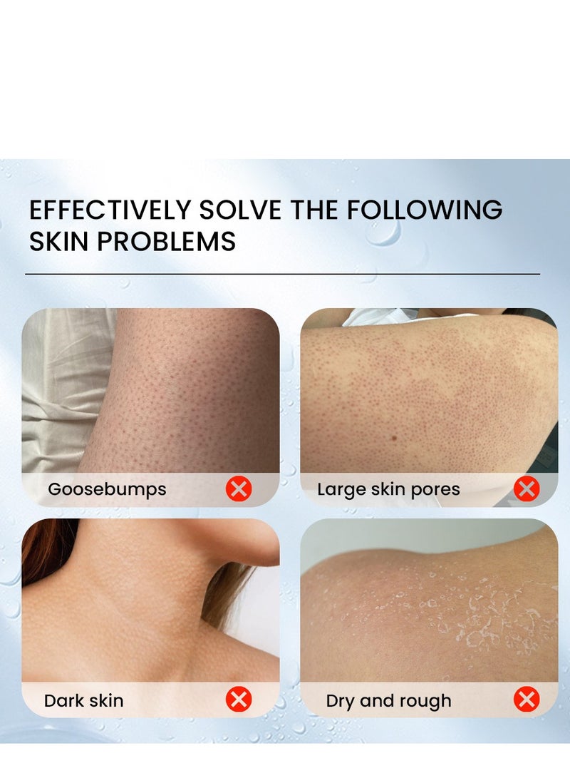 Sumifun Keratosis Pilaris Repair Cream,Vitamin E cream, urea to remove dead skin cells 30g - Image 5