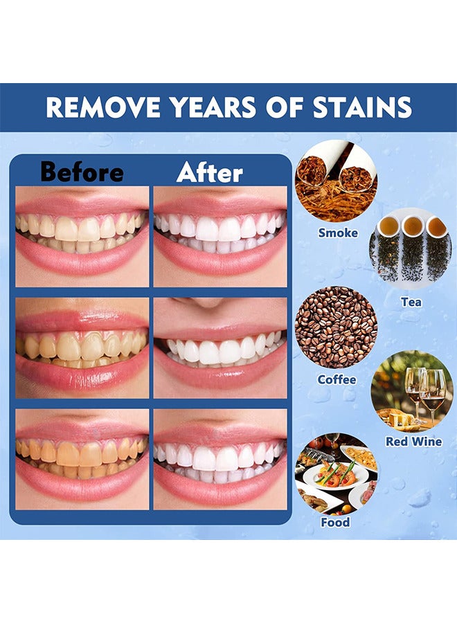 MABREM Teeth Brightening Pen, Teeth Whitening Gel With Applicator, Teeth Whitener, Teeth Stain Remover, Fast Removes Years Of Stains, Effective and Painless Teeth Whitener, Painless, No Sensitivity, Mint - Image 4