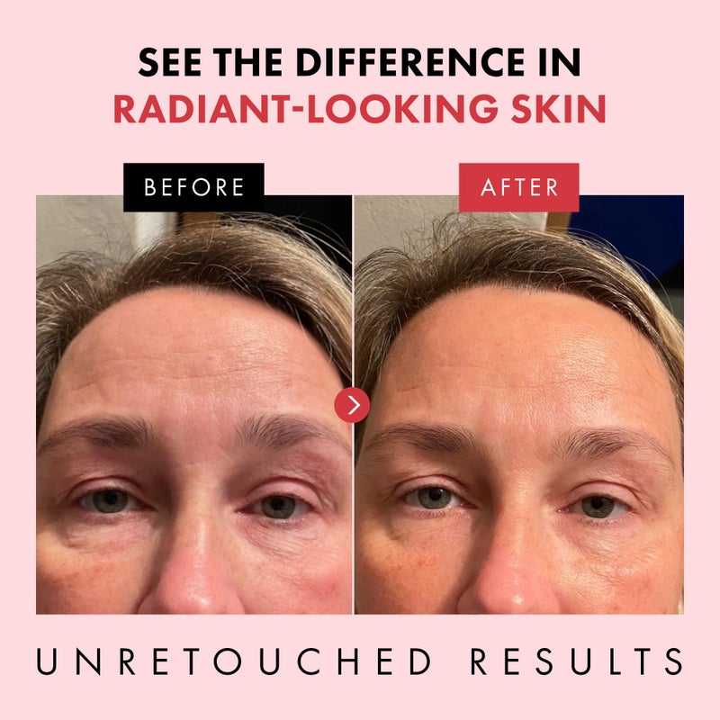 Eclat Skincare Retinol Night Cream â€“ Renewing Retinol Cream for Face with Hyaluronic Acid â€“ Anti Aging to Smooth Wrinkles & Fine Lines - Firming & Hydrating Face Moisturizer for Women & Men 50 ml - Image 3