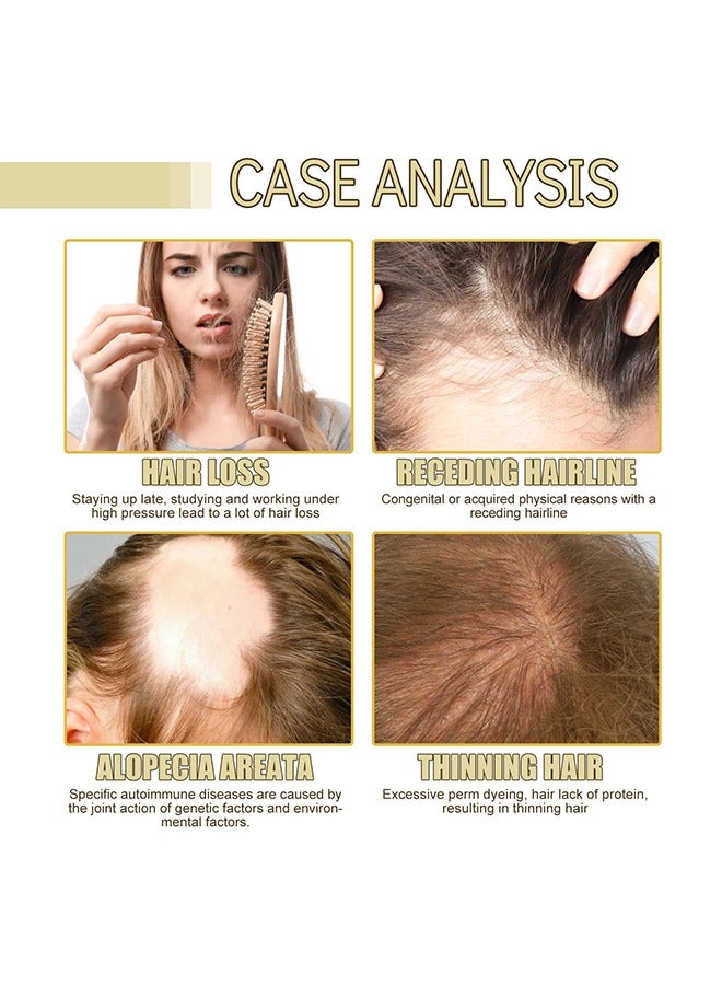 EELHOE Hair Growth Oil, Rosemary Hair Growth Essential Oil, Anti Hair Loss Fast Regrowth Essence, Repair Damaged Frizzy Thinning Scalp Hair-restorer Dense, Hair Growth Serum, 60ml/2 fl.oz - Image 4