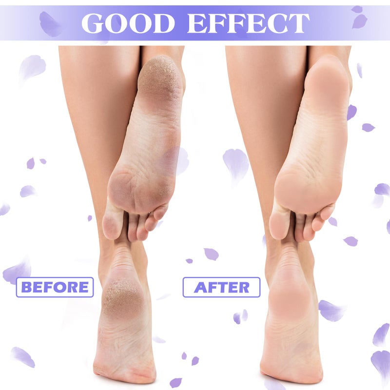 Tarpop 3 Pairs Aloe Socks Women Valentines Day Moisturizing Spa Socks for Dry Cracked Heel Feet Infused Gel Sleeping Fuzzy Lotion Gift for Women Men Softening Dry Feet(Purple and White) - Image 3