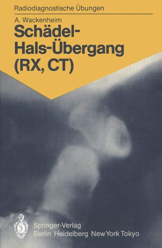 Schädel-Hals-Übergang (RX, CT) - pzsku/ZDC86FD2AAD17E79A65D4Z/45/1749123008/b6a2f90d-a715-44ed-854e-aa9f2f13c1bb