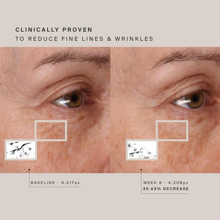 HIGHERDOSE قناع الوجه لعلاج الضوء الأحمر من HigherDOSE - علاج ضوئي LED منزلي بدون أسلاك - يعزز تجديد الخلايا، الشفاء، وبشرة متألقة - قناع LED للوجه يستهدف الخطوط الدقيقة، التجاعيد، والاحمرار - Image 5