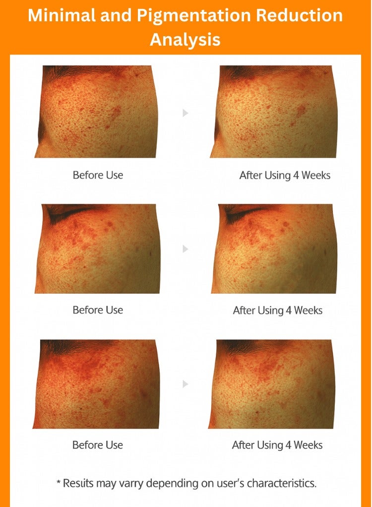 J'sDerma 5% Niacinamide and Vitamin C Face Serum for Skin Brightening Vitanate VD Ampoule 15ml - Image 5