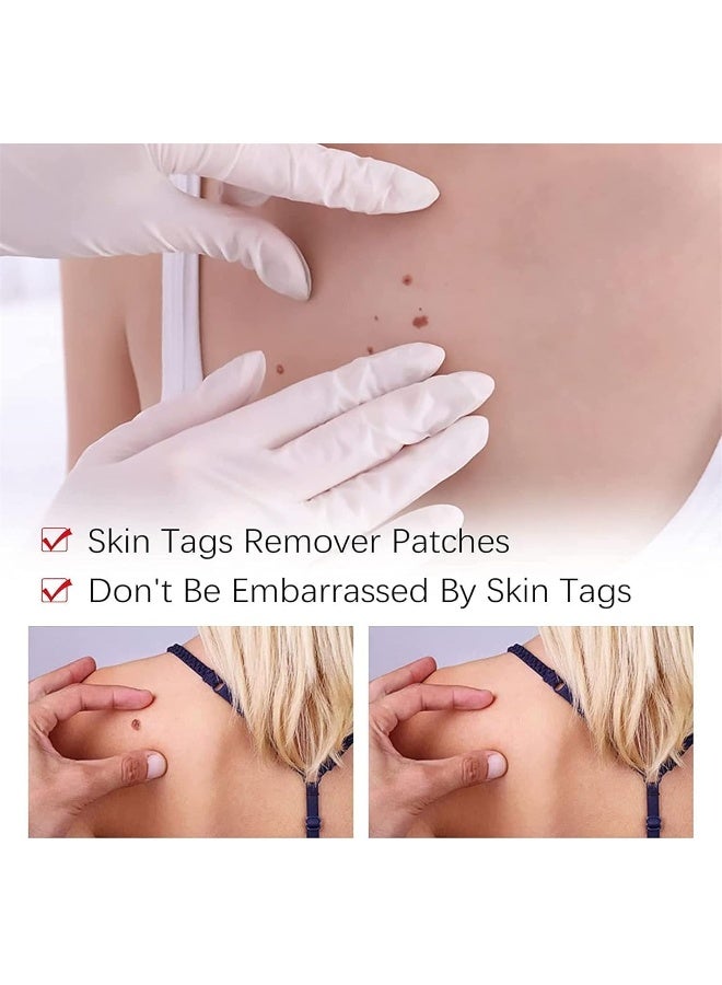 2023 Best Wipeoff Tags & Moles Remover, Mole Remover Fast Easy Effective in 5 Days, Easy to Remove, Restore Skin Health and Beauty, for All Body Parts (1Pcs) - Image 5