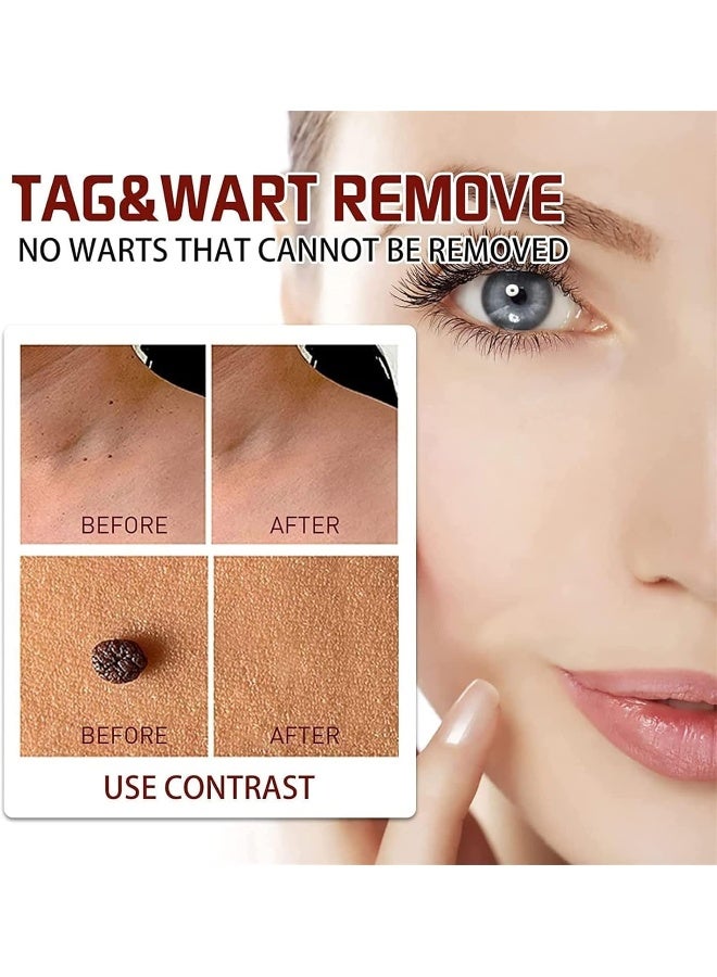 2023 Best Wipeoff Tags & Moles Remover, Mole Remover Fast Easy Effective in 5 Days, Easy to Remove, Restore Skin Health and Beauty, for All Body Parts (1Pcs) - Image 2