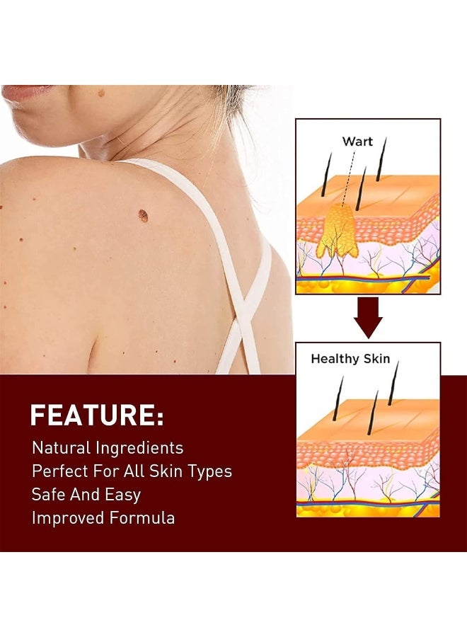 2023 Best Wipeoff Tags & Moles Remover, Mole Remover Fast Easy Effective in 5 Days, Easy to Remove, Restore Skin Health and Beauty, for All Body Parts (1Pcs) - Image 3