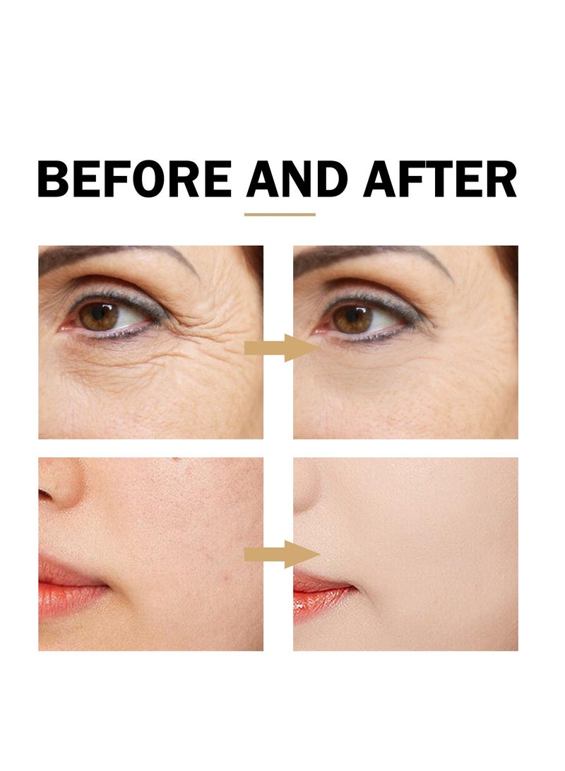 إيلهو سيروم توهج تصحيح البقع الداكنة ، مصل النياسيناميد للوجه ، مصل حمض الهيالورونيك ، مزيل التصبغ ، مصل الوجه للنساء ، ترطيب عميق ، مضاد للشيخوخة وتقليص التجاعيد 100 مل - Image 5