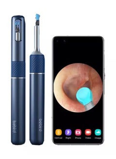 Note5 Ear Wax Removal Tool With Camera, Ear Cleaner And Ear Pick - Starry Blue
