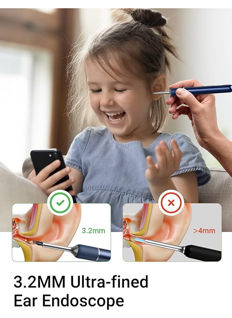Bebird - Note5 Ear Wax Removal Tool With Camera, Ear Cleaner And Ear Pick - Starry Blue - Image 1
