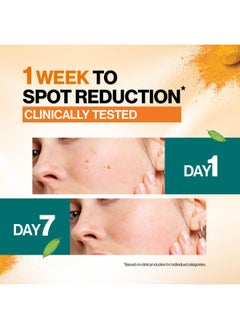 Himalaya Dark Spot Clearing Turmeric Serum  - Image 5