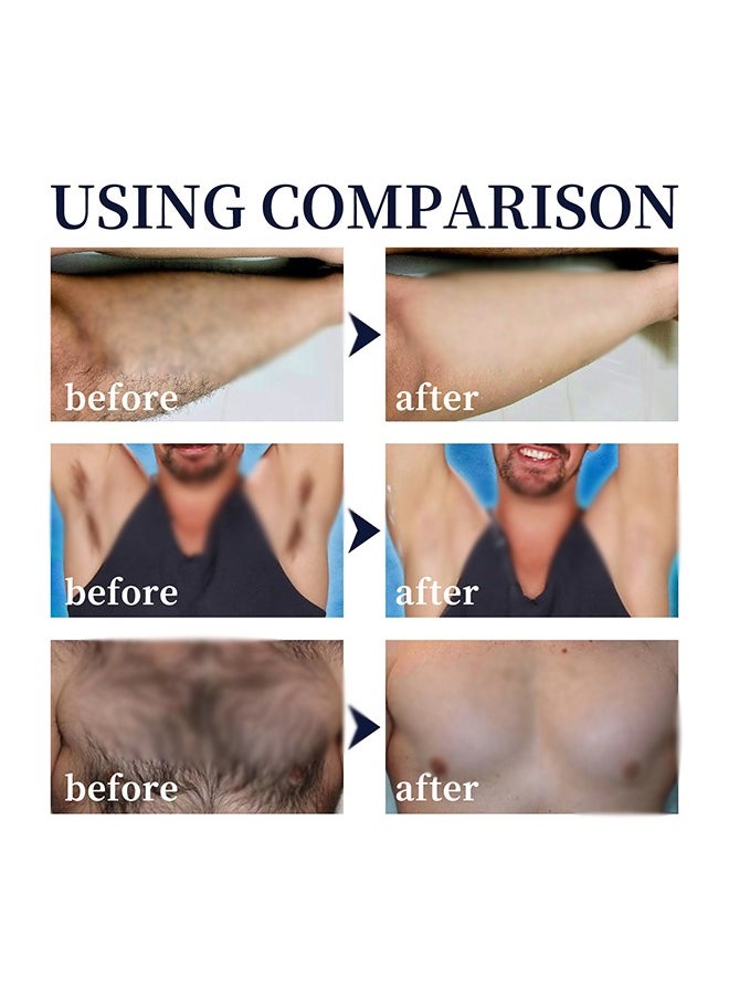 Hair Removal Spray Foam，Painless Hair Removal Spray Armpit Gentle Hair Remover Refreshing Quick Hair Removal Spray, Safe Hair Depilatory For Male Underarm, Chest, Back, Legs 100ML - pzsku/ZDCAA8FE587F04BFDEFC2Z/45/1741250437/7562536c-1e11-4412-baa0-20f176e7db0e