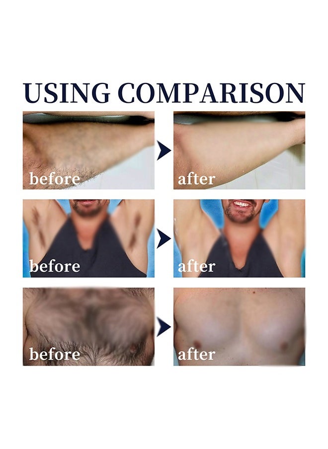 East Moon - Hair Removal Spray Foam，Painless Hair Removal Spray Armpit Gentle Hair Remover Refreshing Quick Hair Removal Spray, Safe Hair Depilatory For Male Underarm, Chest, Back, Legs 100ML - Image 1