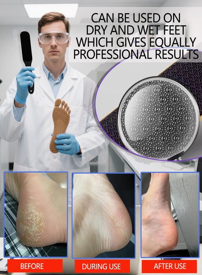 Maeysiph Nano Glass Foot File, Callus Remover for Feet, Wet and Dry Feet Dead Skin Remover, Durable Foot Scrubber, Double-Sided Safe Hygienic Pedicure Tools for Feet, Long Lasting Foot Care Soft Smooth Feet - Image 4