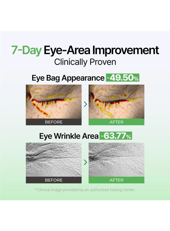 IZEZE Exosome PDRN Firming Eye Cream | Pdrn Eye Cream, Eye Firming Cream, Korean Eye Cream for Dark Circles, Wrinkle Treatment, Firming, Lifting, Under Eye Bags, Nasolabial Fold and Neck, 1.01 fl.oz - Image 4