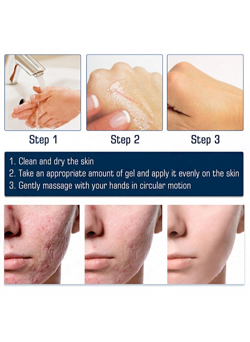 2 Pieces Of High-Grade Formula Scar Gel，New And Old Scar Repair Cream, Effective In Removing Burn Scars And Surgical Scars