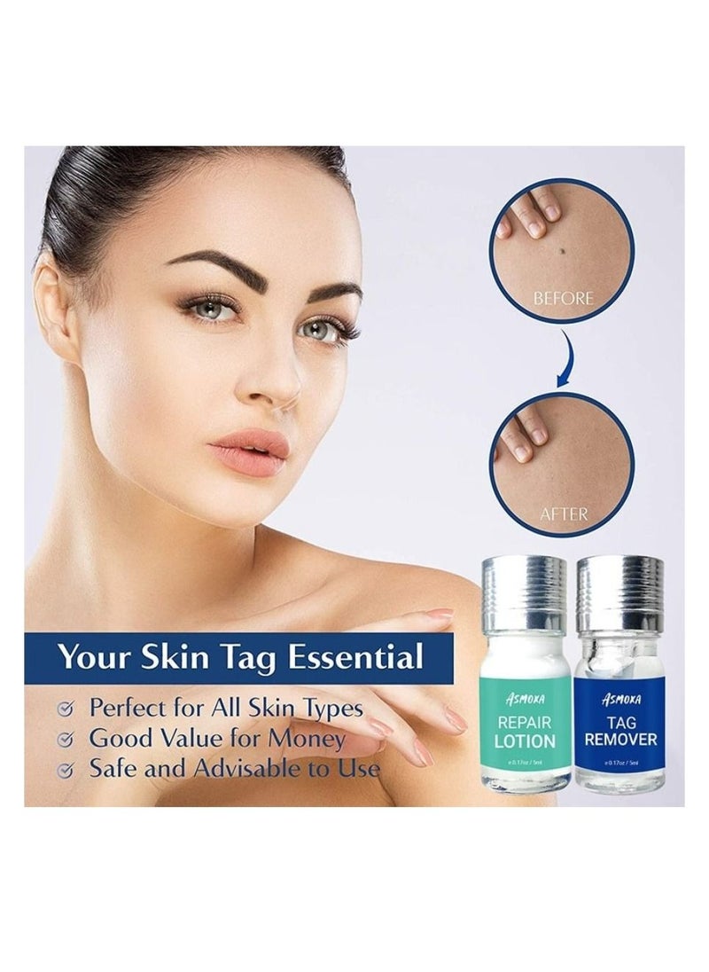 ASMOXA Skin Tag Remover, Mole Remover & Skin Tag Removal Repair Lotion Set, Remove Moles and Skin Tags with Natural Ingredients for Safe & Quick Removal,for Home Use  - Image 4