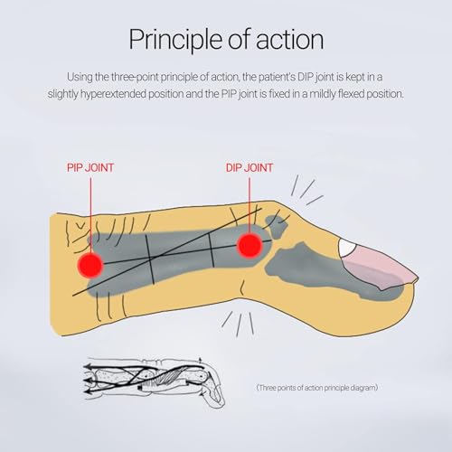 9UP® Plastic Ring Finger Splints Protector Brace Stabilizer For Broken | Mallet Splints Support For Arthritis Basketball (2nd Finger (Ring Finger), Standard) - Image 2