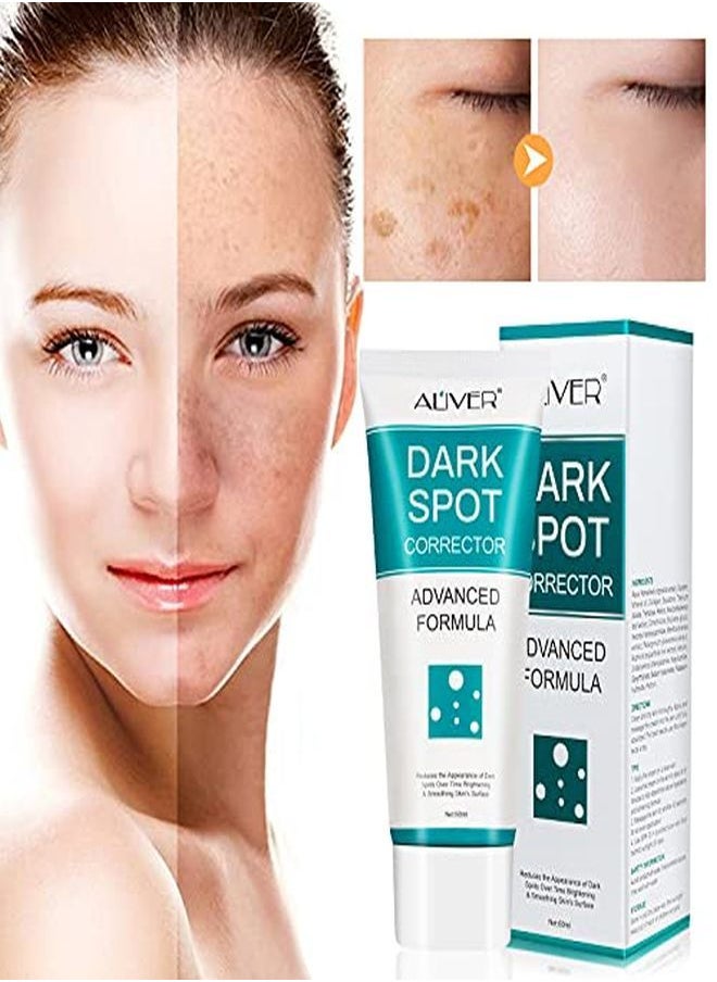 ALIVER - Dark Spot Remover For Face Dark Spot Corrector Cream Fade Out The Skin Black Precipitate Remove Freckle For Face Fade Spots For All Skin Tone Types - Image 1