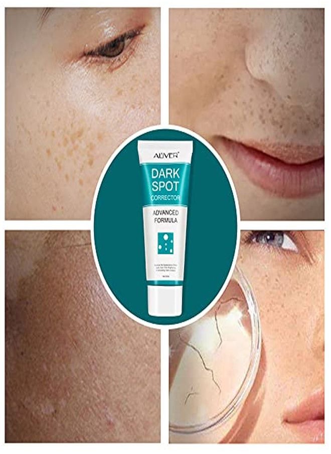 ALIVER - Dark Spot Remover For Face Dark Spot Corrector Cream Fade Out The Skin Black Precipitate Remove Freckle For Face Fade Spots For All Skin Tone Types - Image 1