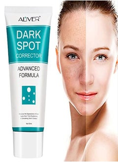 Dark Spot Remover For Face Dark Spot Corrector Cream Fade Out The Skin Black Precipitate Remove Freckle For Face Fade Spots For All Skin Tone Types