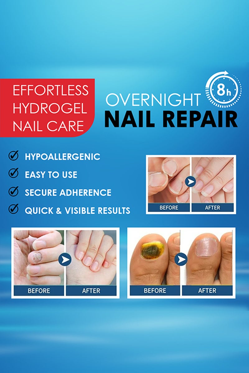 Kanza 21 قطعة لاصقة لعلاج فطريات الأظافر تجدد بنية الأظافر وتحسن تغير اللون خلال الليل لاصقة إصلاح الأظافر لفطريات الأظافر التالفة 8 ساعات تجديد ليلي - Image 5