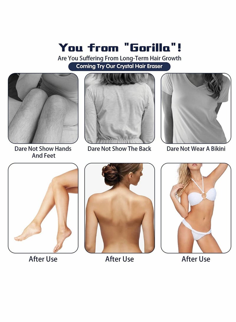 Hair Removal Eraser, Painless Crystal Remover Tools Magic Eraser - Image 5