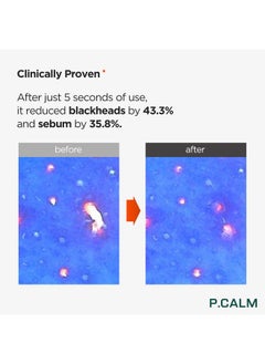 P.CALM Underpore Holy Basil Cleansing Oil 190Ml | Instant Blackhead Reducing Pore Control Cleansing Oil With Holy Basil Extract For Sensitive Skin | Korean Skincare  - Image 5