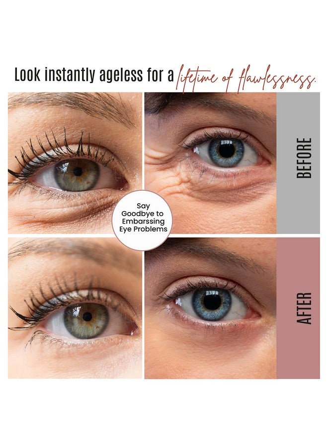 dermaxgen Instant Eyelift Cream Time Reverse Treatment For Dark Circles Puffy Eyes & Wrinkles Anti Aging Serum Reduces Under Eye Bags Wrinkles Dark Circles Fine Lines & Crow'S Feet Instantly 12 - Image 5