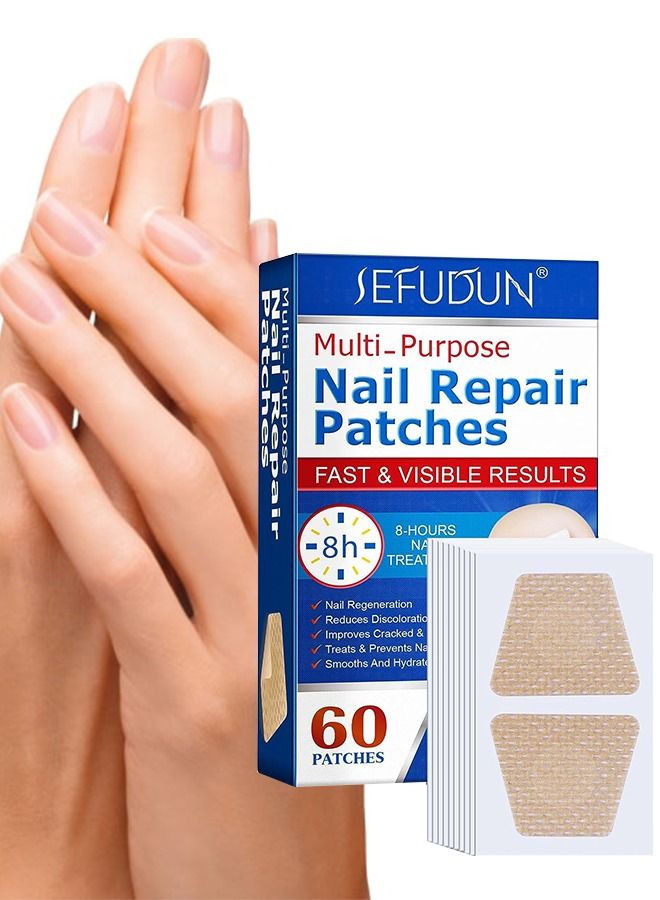 Sefudun 60 قطعة من لاصقات إصلاح الأظافر لعلاج فطريات أظافر القدم علاج إصلاح الأظافر بقوة إضافية يعيد مظهر الأظافر المتغيرة اللون أو التالفة - Image 1