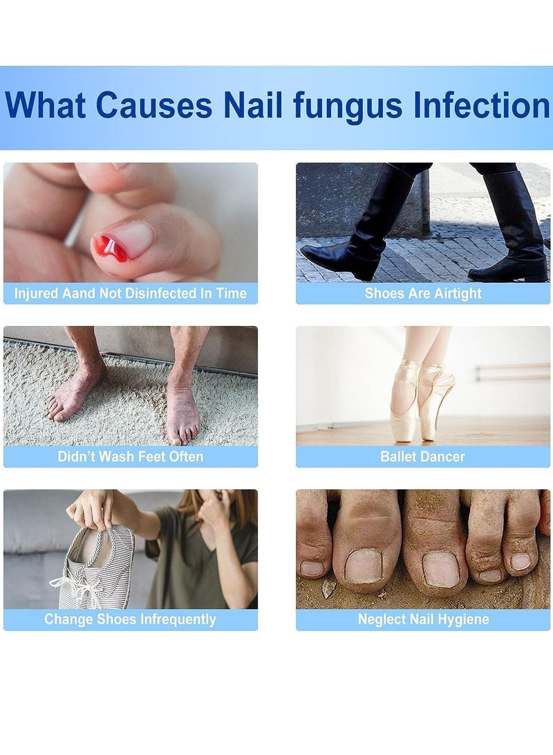 Sefudun 60 قطعة من لاصقات إصلاح الأظافر لعلاج فطريات أظافر القدم علاج إصلاح الأظافر بقوة إضافية يعيد مظهر الأظافر المتغيرة اللون أو التالفة - Image 3