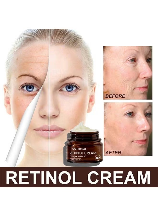 Lanthome Retinol Cream 50ML RETINOL CREAM Facial Care Cream - Image 3
