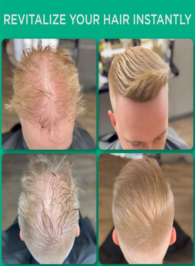 THICK FIBER Hair Fibers for Thinning Hair & Bald spots (MEDIUM BLONDE, Pack of 2) - 25g Bottle - Conceals Hair Loss in Seconds - Hair Powder For Women & Men - Image 2