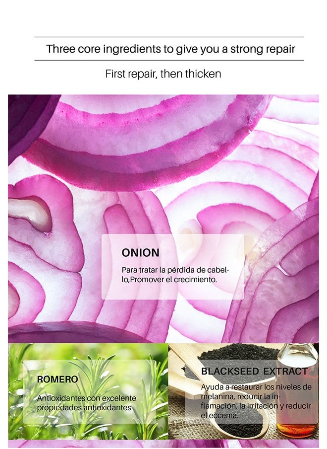 Lanthome Onion Rosemary Blackseed Extract，Hair Growth Spray, Onion Oil for Hair Growth Organic, Rosemary Enriched, Black Seed Oil for Hair Loss Control, Promotes Hair Growth  - Image 3