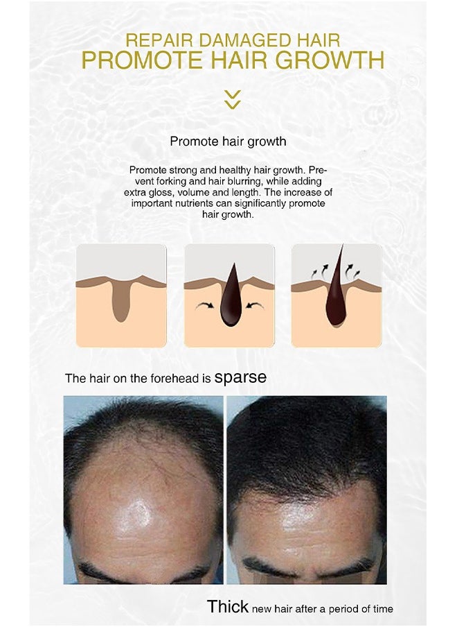 Lanthome Onion Rosemary Blackseed Extract，Hair Growth Spray, Onion Oil for Hair Growth Organic, Rosemary Enriched, Black Seed Oil for Hair Loss Control, Promotes Hair Growth  - Image 4