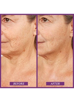 PRAI Beauty Ageless Throat & Decolletage Serum for Instantly Ageless Neck | Neck Firming and Tightening Serum | Anti-Aging Serum that Shields Skin from Damage and Improves Skin Tone + Colour | 4 Oz  - Image 2